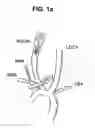 Fig. 02 - Cell-seeded tissue-engineered polymers for treatment of intracranial aneurysms