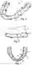 Fig. 02 - Orthodontic systems with resilient appliances