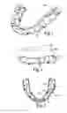 Fig. 02 - Methods of orthodontic treatment