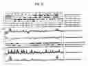 Fig. 22 - 12 human secreted proteins