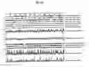 Fig. 41 - 12 human secreted proteins