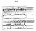 Fig. 50 - 12 human secreted proteins