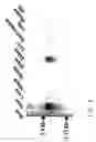 Fig. 06 - UDP-galactose: β-D-galactose-R 4-α-D-galactosyltransferase, α4Gal-T1