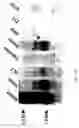 Fig. 07 - UDP-galactose: β-D-galactose-R 4-α-D-galactosyltransferase, α4Gal-T1