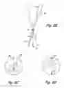 Fig. 08 - Method for dealing with singularities in gravity referenced endoscopic imaging