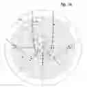 Fig. 09 - Method for dealing with singularities in gravity referenced endoscopic imaging