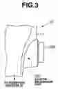 Fig. 04 - Electrical bending endoscope