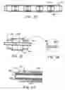 Fig. 07 - Extended treatment zone catheter