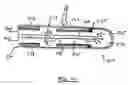Fig. 16 - Extended treatment zone catheter