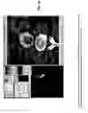Fig. 32 - Method for determining the risk of rupture of a blood vessel