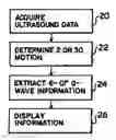 Fig. 01 - Automated diastolic function analysis with ultrasound
