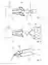 Fig. 04 - Instrumented retrievable implantable device