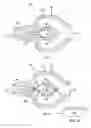 Fig. 03 - Spirometer