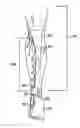 Fig. 01 - Methods for the assessment of neuromuscular function by F-wave latency