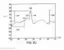 Fig. 12 - Methods for the assessment of neuromuscular function by F-wave latency