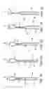 Fig. 08 - Steerable loop tip wire-guide