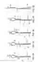 Fig. 10 - Steerable loop tip wire-guide