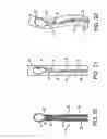 Fig. 11 - Steerable loop tip wire-guide