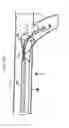 Fig. 13 - Steerable loop tip wire-guide