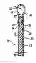 Fig. 01 - Loop tip wire guide