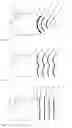 Fig. 05 - Pressure pulse/shock wave apparatus for generating waves having nearly plane or divergent characteristics