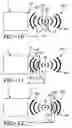 Fig. 09 - Pressure pulse/shock wave therapy methods and an apparatus for conducting the therapeutic methods