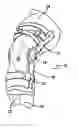 Fig. 01 - Adjustable knee brace