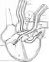 Fig. 01 - Transport pump and organ stabilization apparatus including related methods