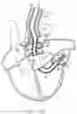 Fig. 16 - Transport pump and organ stabilization apparatus including related methods