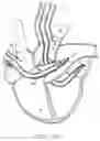Fig. 18 - Transport pump and organ stabilization apparatus including related methods