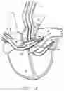 Fig. 19 - Transport pump and organ stabilization apparatus including related methods