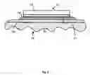 Fig. 03 - Microsurgical tissue treatment system