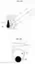 Fig. 08 - METHODS AND DEVICES FOR SELECTIVE BULK REMOVAL AND PRECISION SCULPTING OF TISSUE