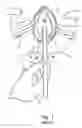 Fig. 02 - Catheter insertion aid