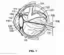 Fig. 02 - Apparatus and processes for preventing or delaying one or more symptoms of presbyopia