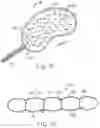 Fig. 07 - Inflatable device for use in surgical protocol relating to fixation of bone
