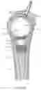 Fig. 09 - Inflatable device for use in surgical protocol relating to fixation of bone