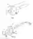 Fig. 02 - Use of vibration in composite fixation