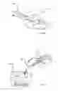 Fig. 17 - Surgical scalpel with retractable guard