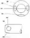 Fig. 01 - Infusion sleeve