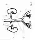 Fig. 02 - Interventional guiding sheath system and method of use