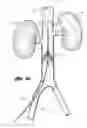 Fig. 07 - Blood clot filter configured for a wire guide
