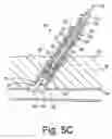 Fig. 07 - Apparatus and methods for sealing a vascular puncture