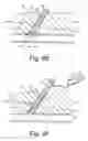 Fig. 09 - Apparatus and methods for sealing a vascular puncture