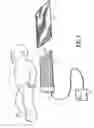 Fig. 02 - Device and method for phototherapy of jaundiced infants