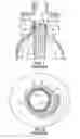 Fig. 02 - Endoluminal device having enhanced affixation characteristics