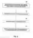 Fig. 04 - Endoluminal device having enhanced affixation characteristics