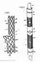 Fig. 02 - Endoprosthesis for vascular bifurcation
