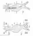 Fig. 02 - Devices, systems, and methods for prosthesis delivery and implantation