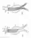 Fig. 03 - Devices, systems, and methods for prosthesis delivery and implantation